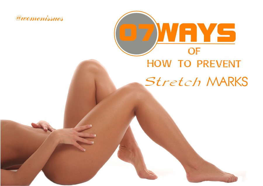 7 Ways of how to prevent stretch marks