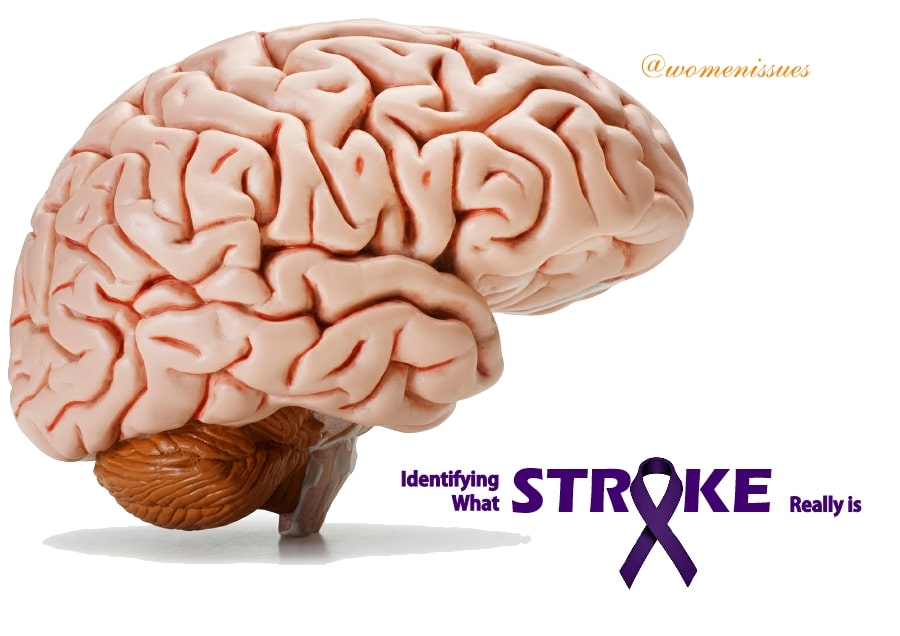 Identifying What Stroke Really is
