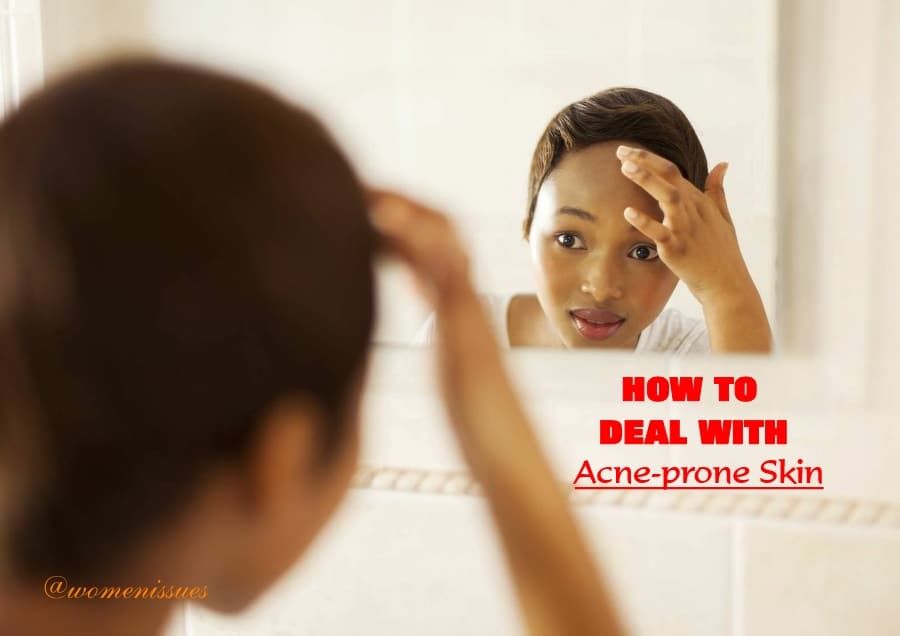 how to deal with Acne-prone skin