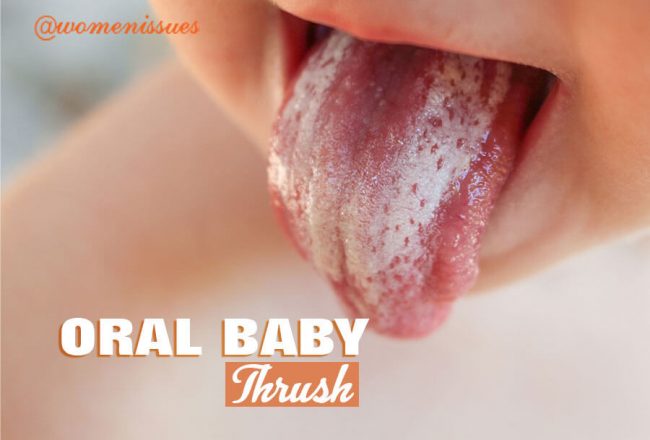 ORAL-BABY-THRUSH-women-issues-new-1 (1)