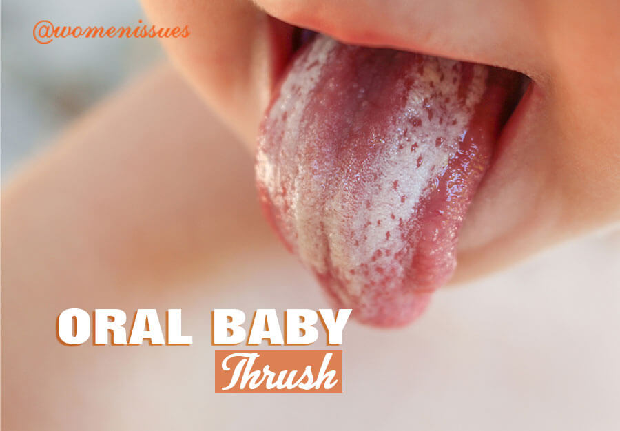 ORAL-BABY-THRUSH-women-issues-new-1 (1)