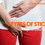 4 Types of sticky vaginal discharge