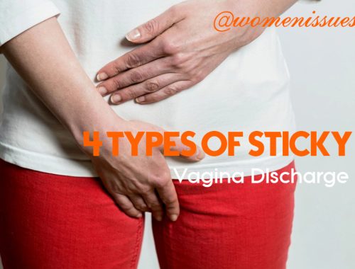 4 Types of sticky vaginal discharge