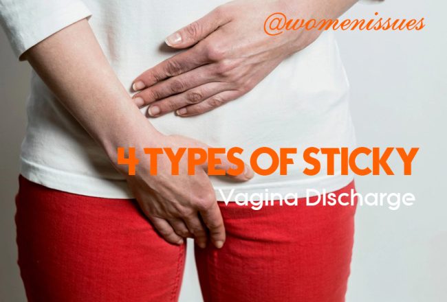 4 Types of sticky vaginal discharge